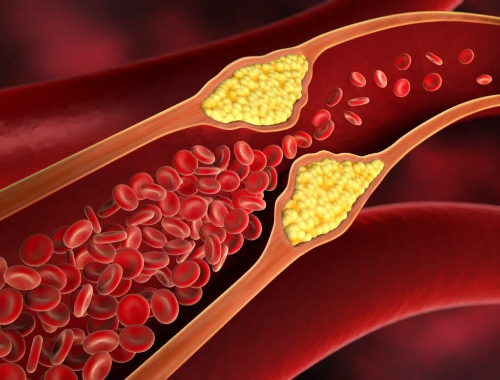 Cholesterol-Control